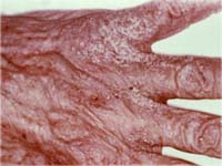 ������� �� ������ ���