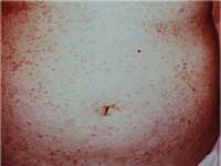 ������� �� ������