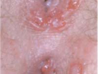 ������������� ��������� � ������