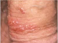 ������������� ��������� � ������