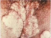 ������������� ���������