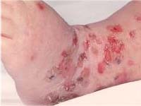 ������ �� ���� �������