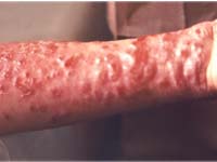 ������ �� ����