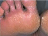 ������� ������������� 1