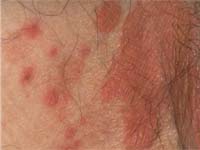 ������� �������������