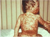 ���������� �� �����