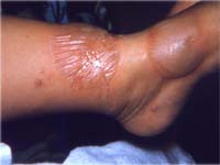 ���������� �� ����