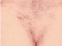 ������� ������� ����� �� �����