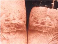 ������� ������� ����� �� �����