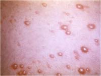 ������ ������������� �����