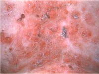 ������� ��� ������������ �����