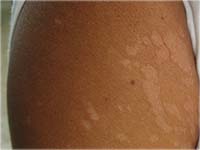 ����� �� ���� ��� ������������ �����