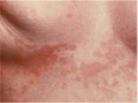 ���������� ����� �������������