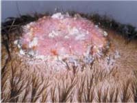 ��������� ����� �� ������