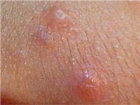 ������ ������������� ��������