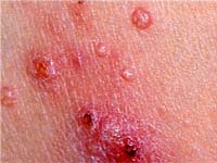 ��� �������� ������������ �������