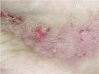 ��������� ��� ������������