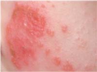 ����������� �� ����