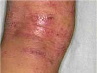 ����������� � ����������� �����