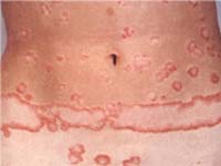 ������� �� ���� ������