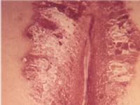 ������� � ������� �������