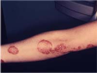 ������� �� ����