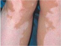 �������� �� �����