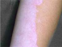 ���� �������� �� ����