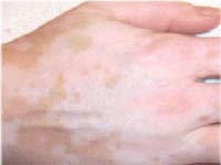 �������� �� ����� ����