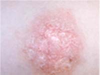 ����������� ������ �������� �����