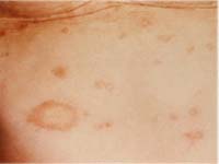 ������� ����� �� �����