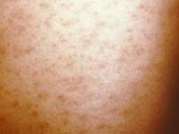 �������� ��������� ��� ������� �����